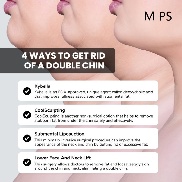 4 ways to get rid of a double chin millennial plastic surgery 768x768