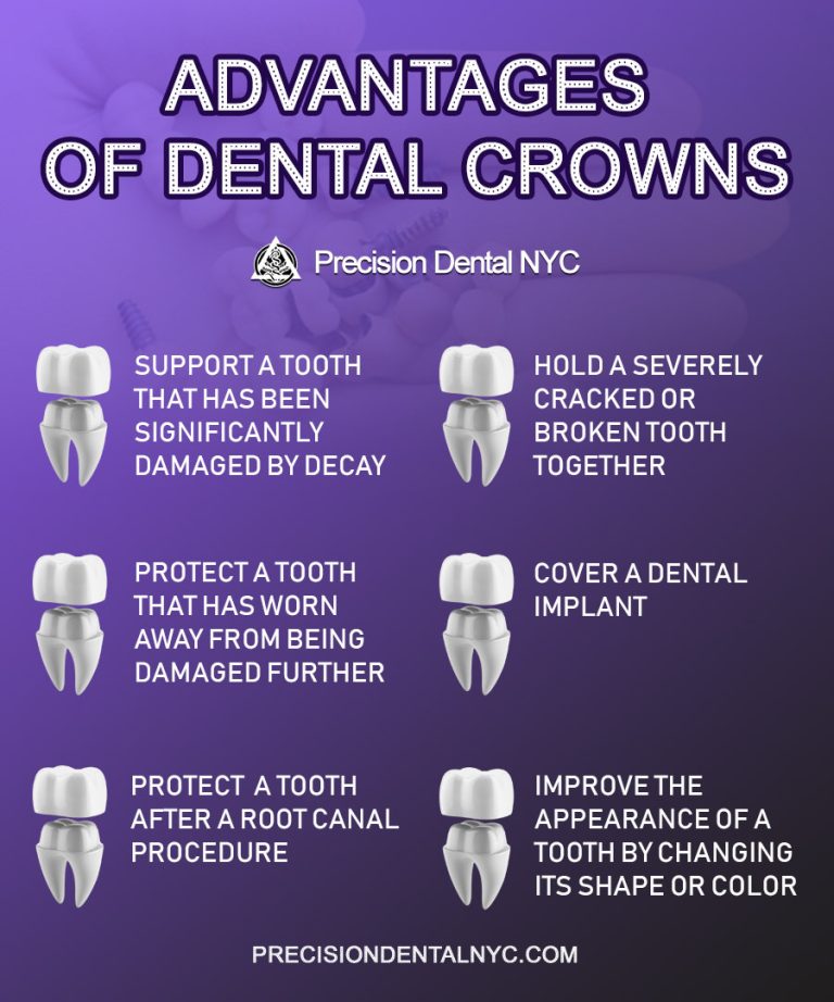 Advantages of Dental Crowns 1 768x922