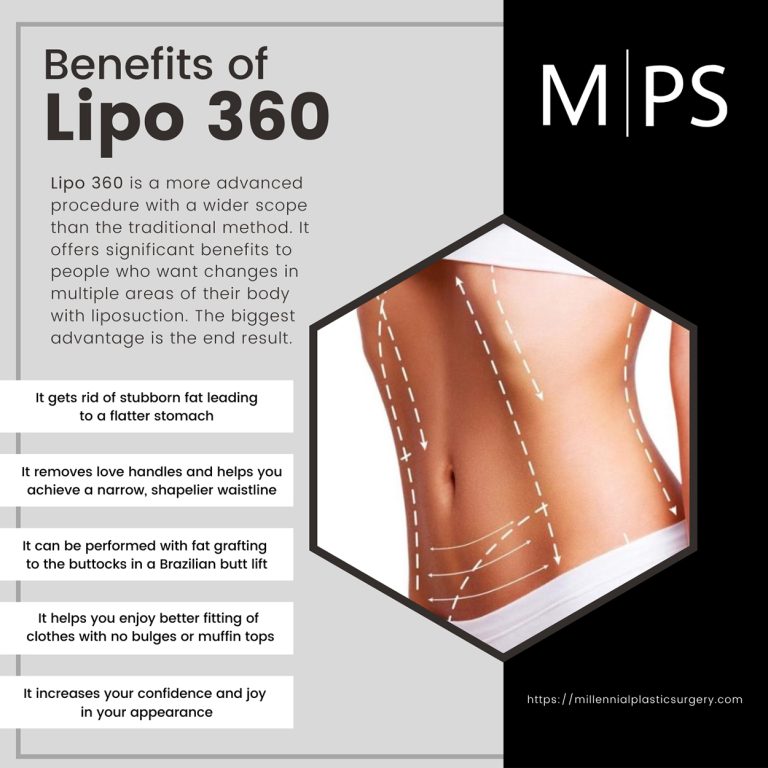 Benefits of Lipo 360 768x768