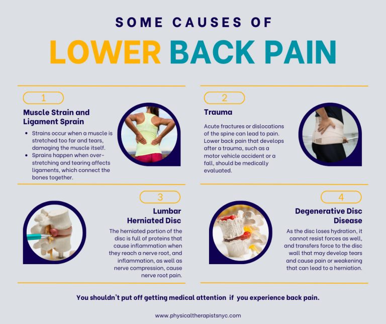 Causes of Lower Back Pain 768x644
