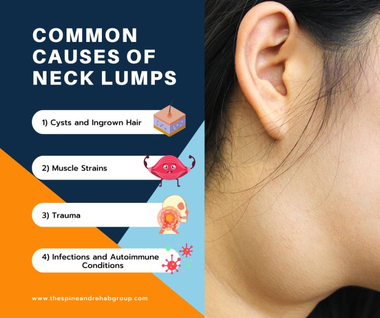 Common Causes of Neck Lumps 768x644