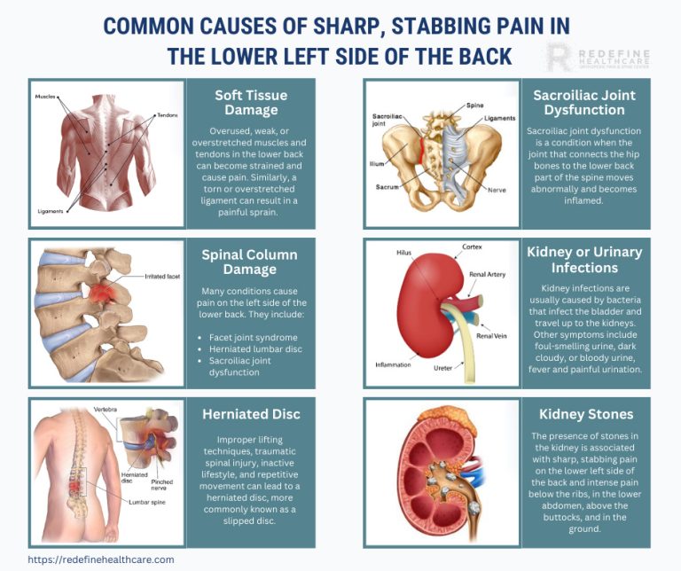 Common Causes of Sharp Stabbing Pain in the Lower Left Side of the Back 768x644