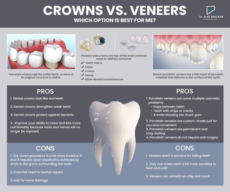 DIFFERENCE BETWEEN PORCELAIN CROWNS AND VENEERS 768x643