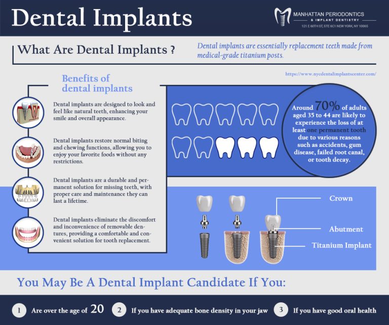 Dental Implants 1 768x643
