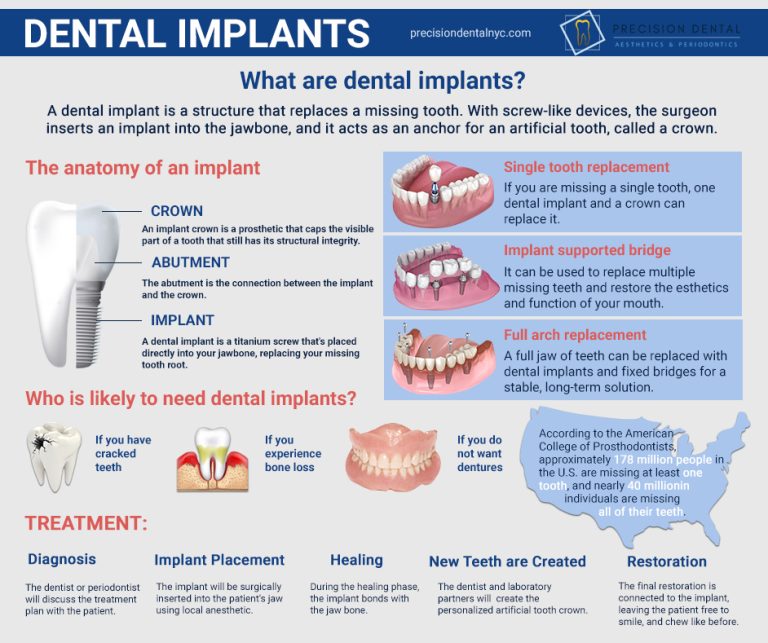 Dental Implants 2 768x643