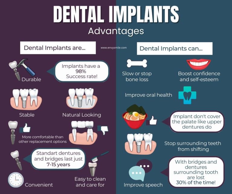 Dental Implants 768x644