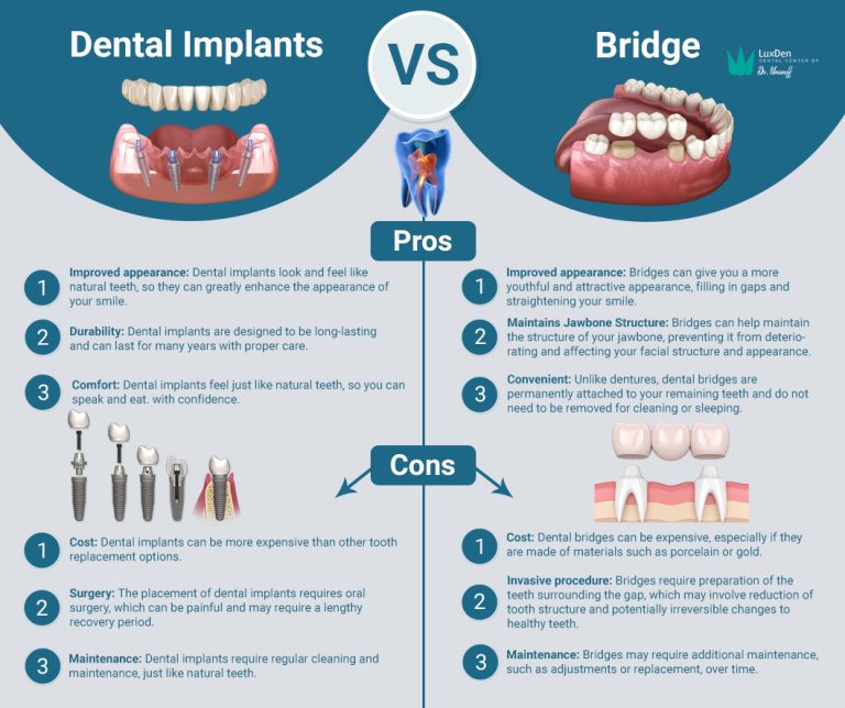 Dental implants vs dental bridge 768x644