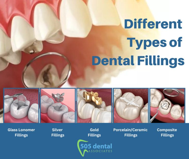 Different Types of Dental Fillings 768x644