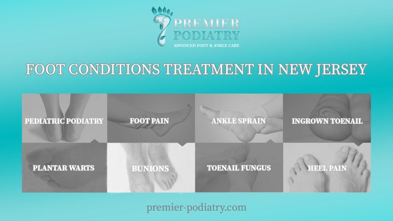 FOOT CONDITIONS TREATMENT IN NEW JERSEY 1 768x432