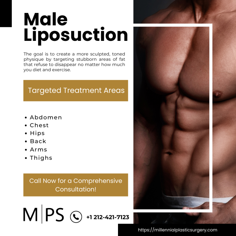 Male Liposuction 768x768