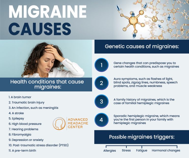 Migraine Causes 768x644