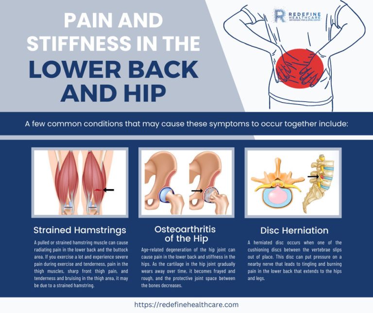 Pain and Stiffness in the Lower Back and Hip 768x644