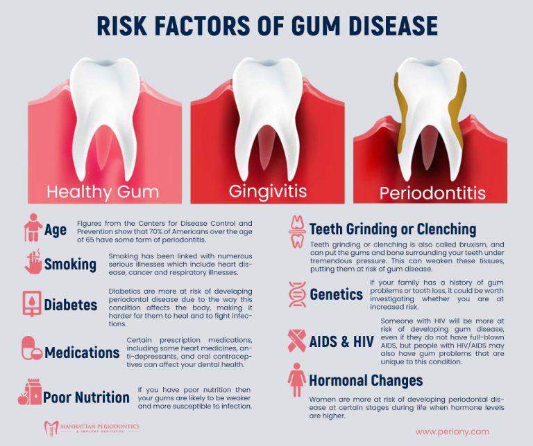 Risk Factors of Gum Disease 768x644