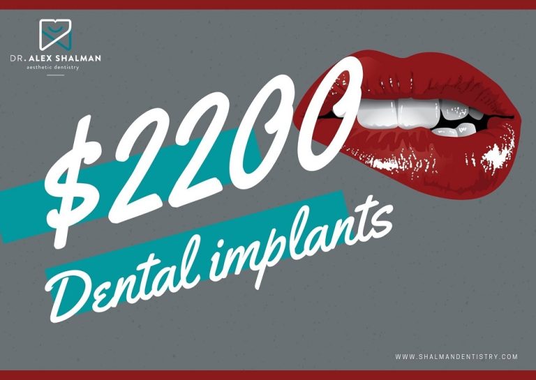 Shalman Dentistry provides dental implants 768x545