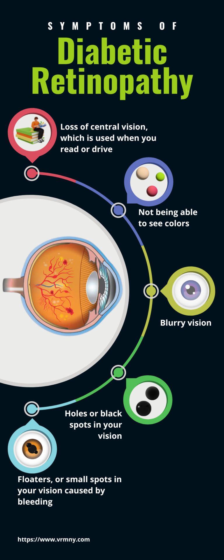 Symptoms of diabetic retinopathy 768x1920