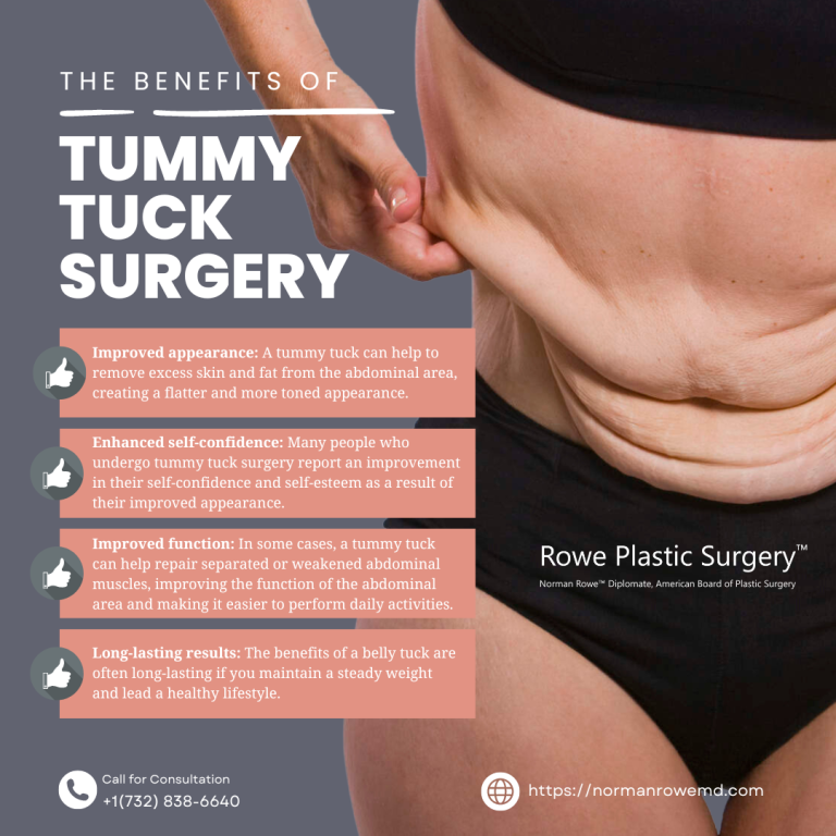 The Benefits of Tummy Tuck Surgery 768x768