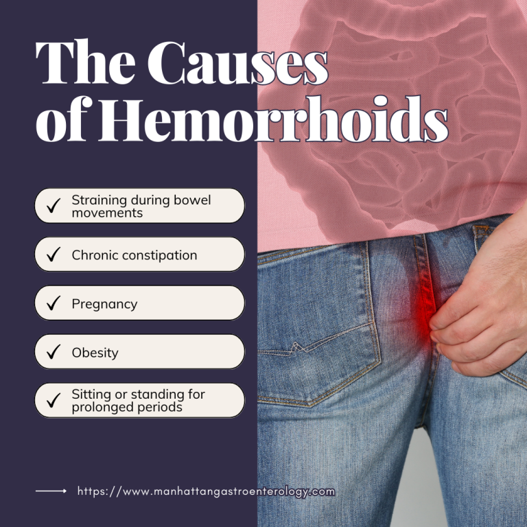 The Causes of Hemorrhoids 768x768