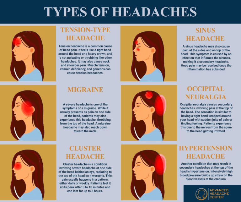 Types of Headache 768x643