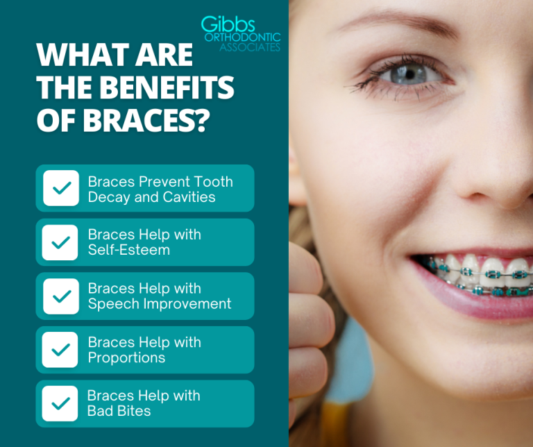 What Are the Benefits of Braces 768x644