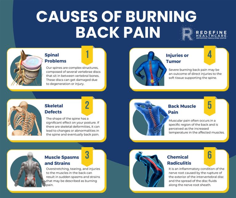 What Causes Burning Back Pain 1 768x644