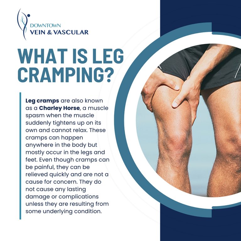 What Is Leg Cramping 768x768