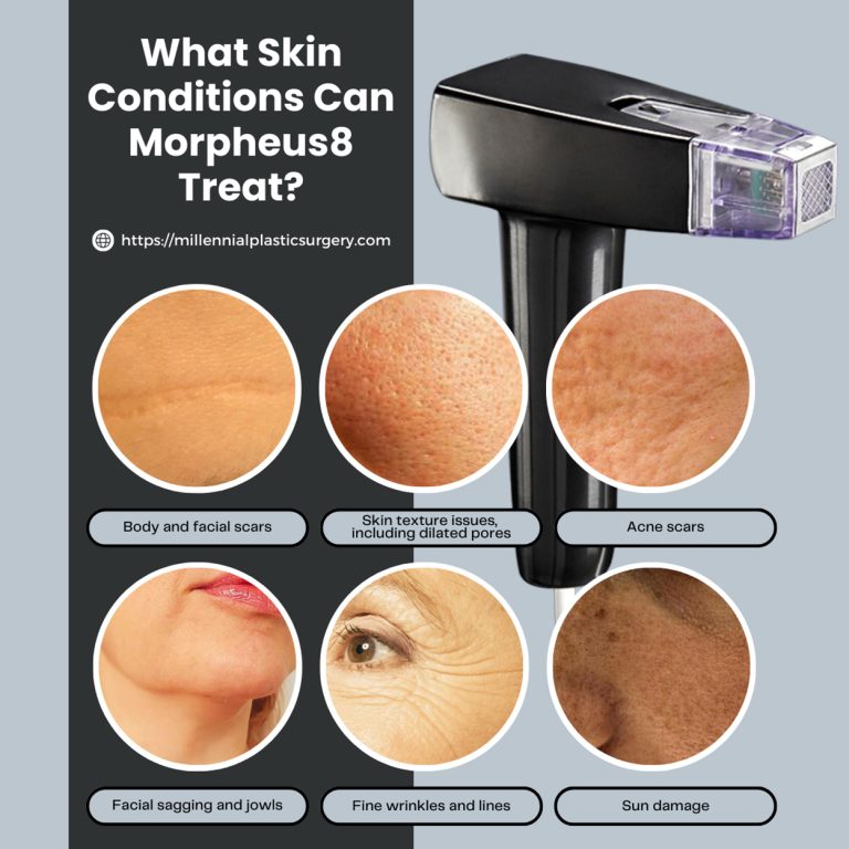 What Skin Conditions Can Morpheus8 Treat 768x768