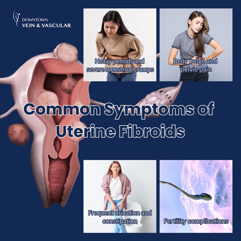 common symptoms of fibroids 768x768
