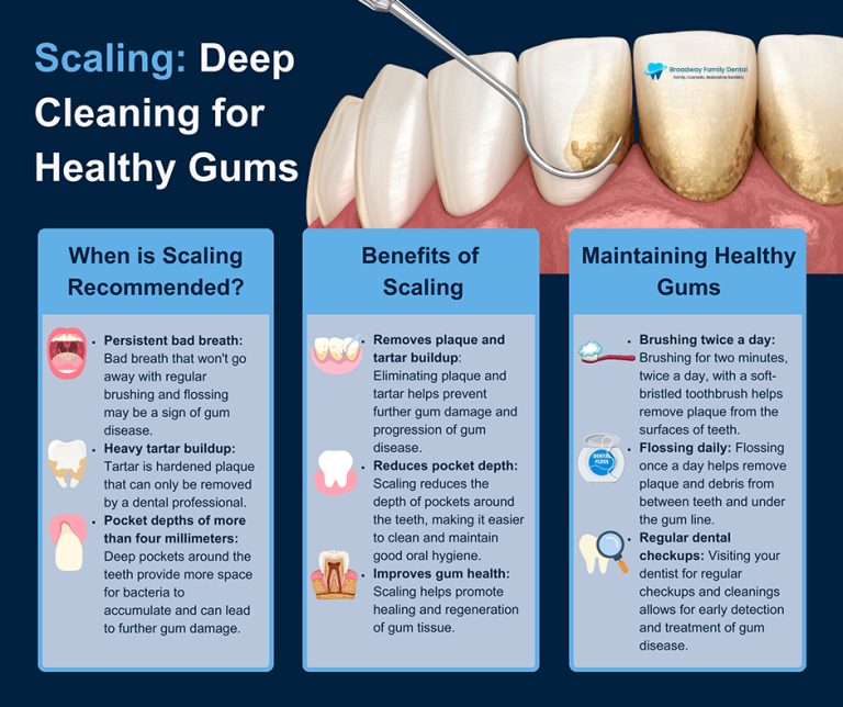 scaling deep cleaning for healthy gums 768x644