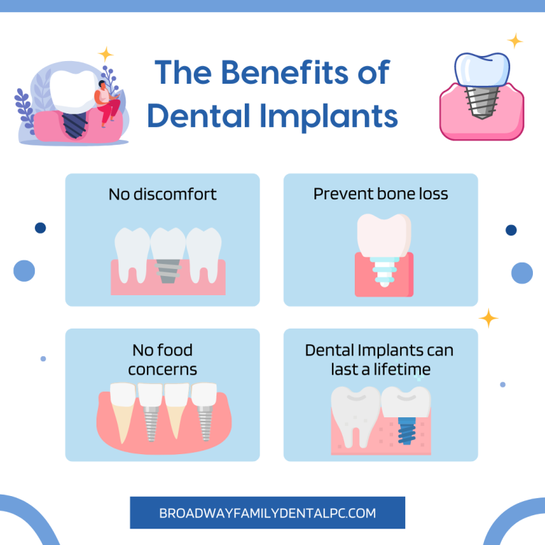the Benefits of Dental Implants 768x768