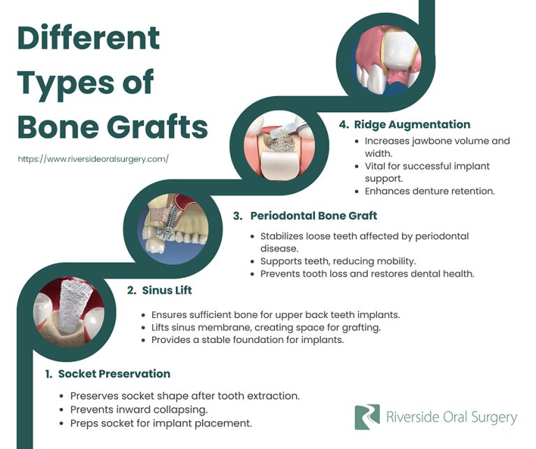 types of bone grafts 768x644