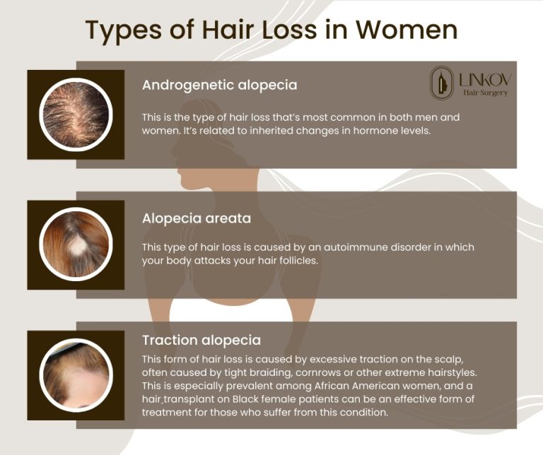 types of hair loss in women 768x644
