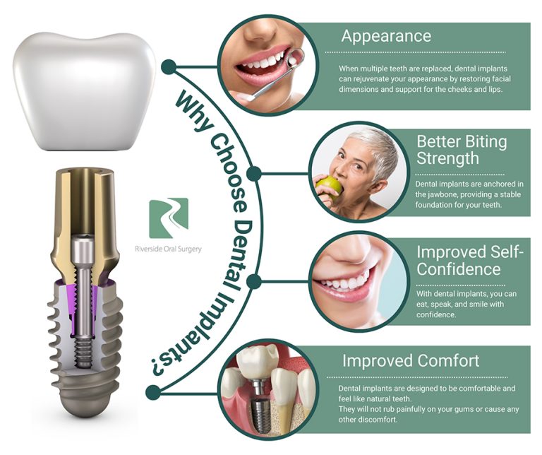 why choose dental implants 768x644