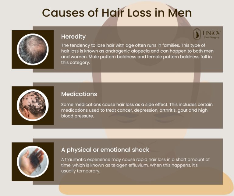 сauses of hair loss in men 768x644