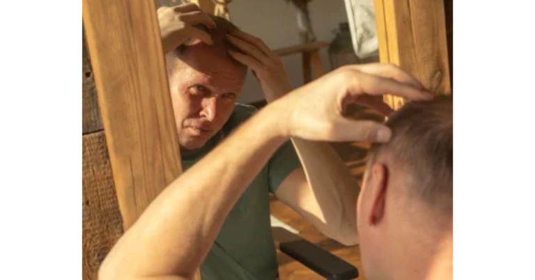 Best Hair Loss Treatment For Men 768x402